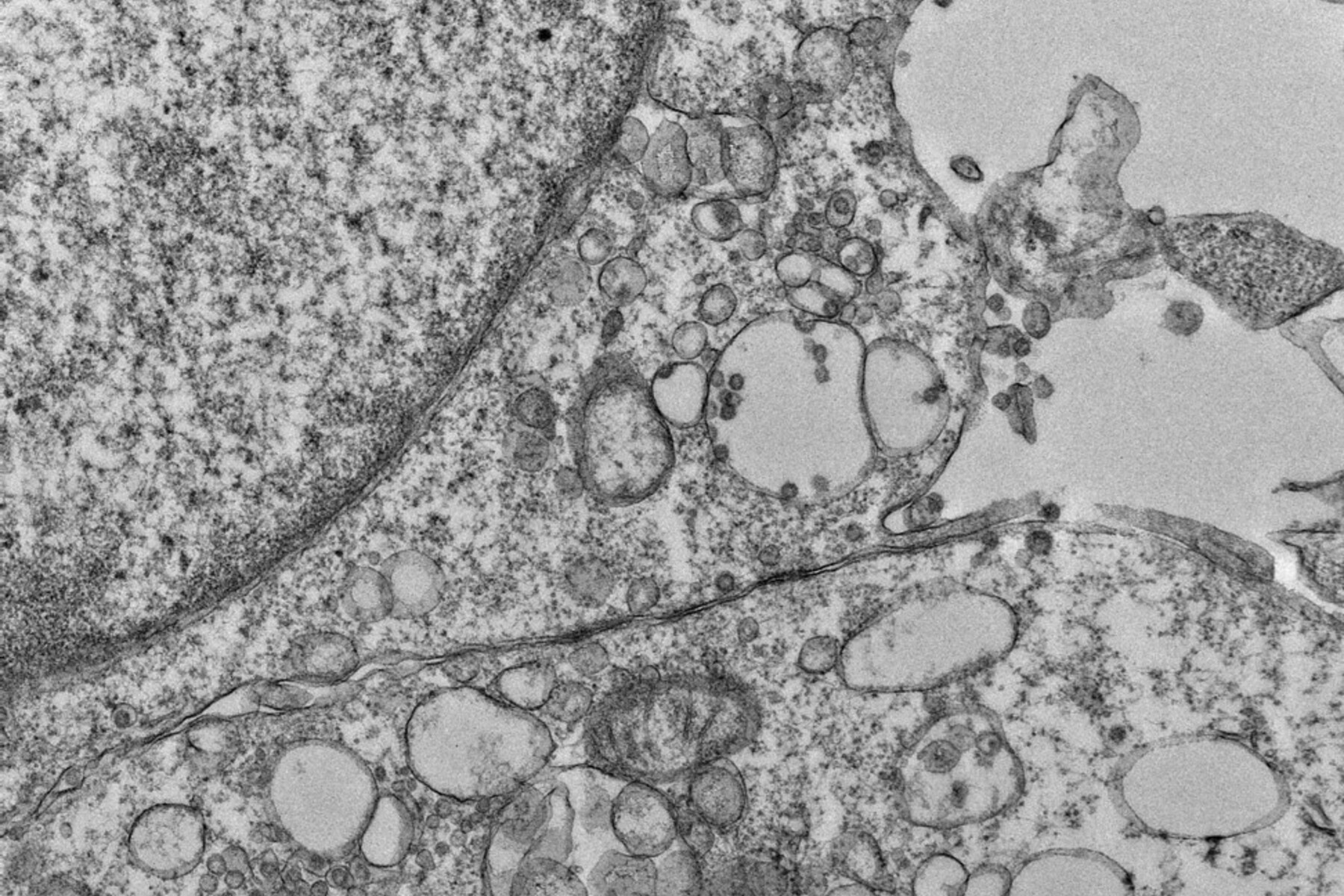 vero cells infected with covic